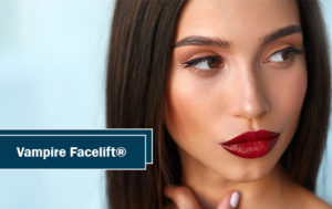 Vampire Facelift The Woodlands TX
