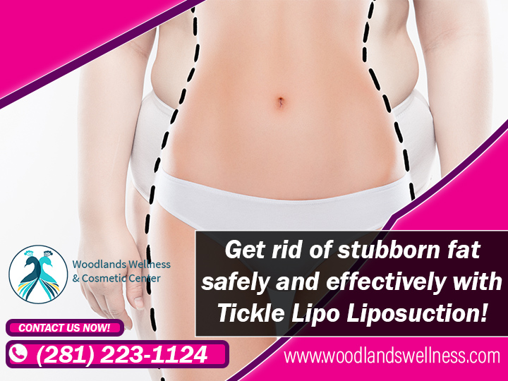 Liposuction The Woodlands TX