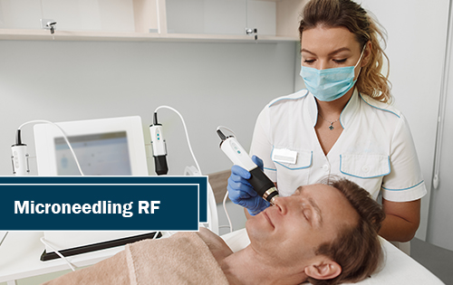 Microneedling RF Woodland TX Microneedling RF Woodlands TX