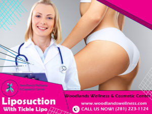 Liposuction The Woodlands TX