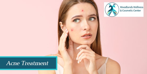 Acne Treatment | Woodlands, TX