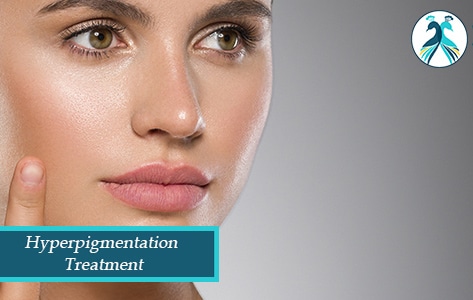 hyperpigmentation treatment in Woodlands TX